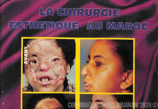 Couverture Message de la Nation n 76  1 mai 1985